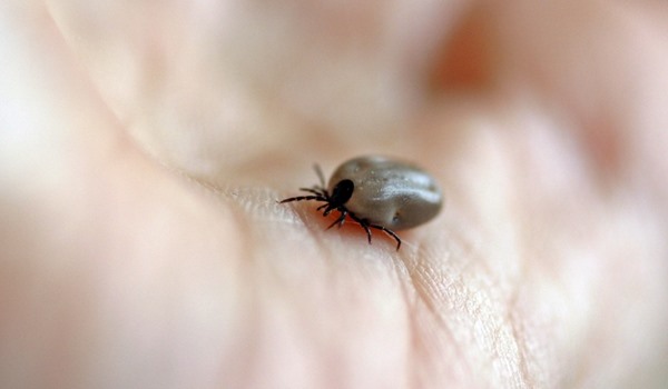How To Remove Ticks From Your Pet